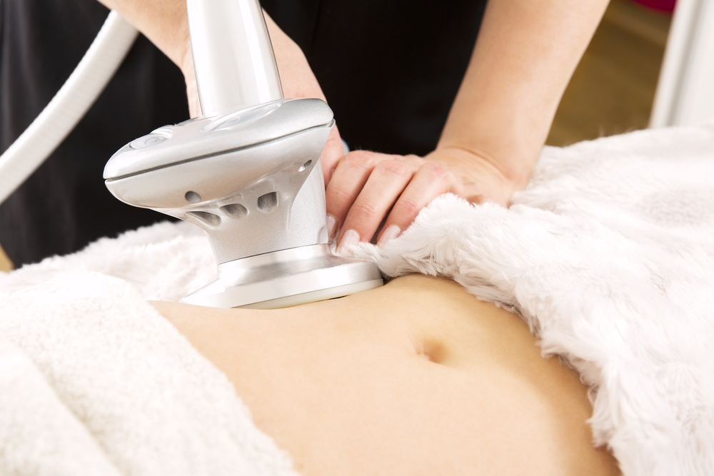 Laser Liposuction