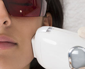 Laser Resurfacing Procedure