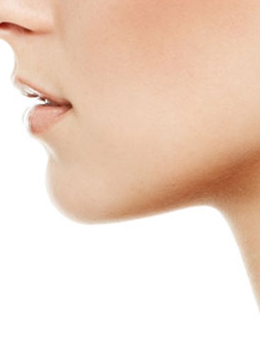 Chin Augmentation