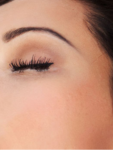 Brow Lift