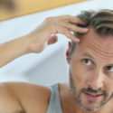 5 Hair Loss Myths…And The Facts!
