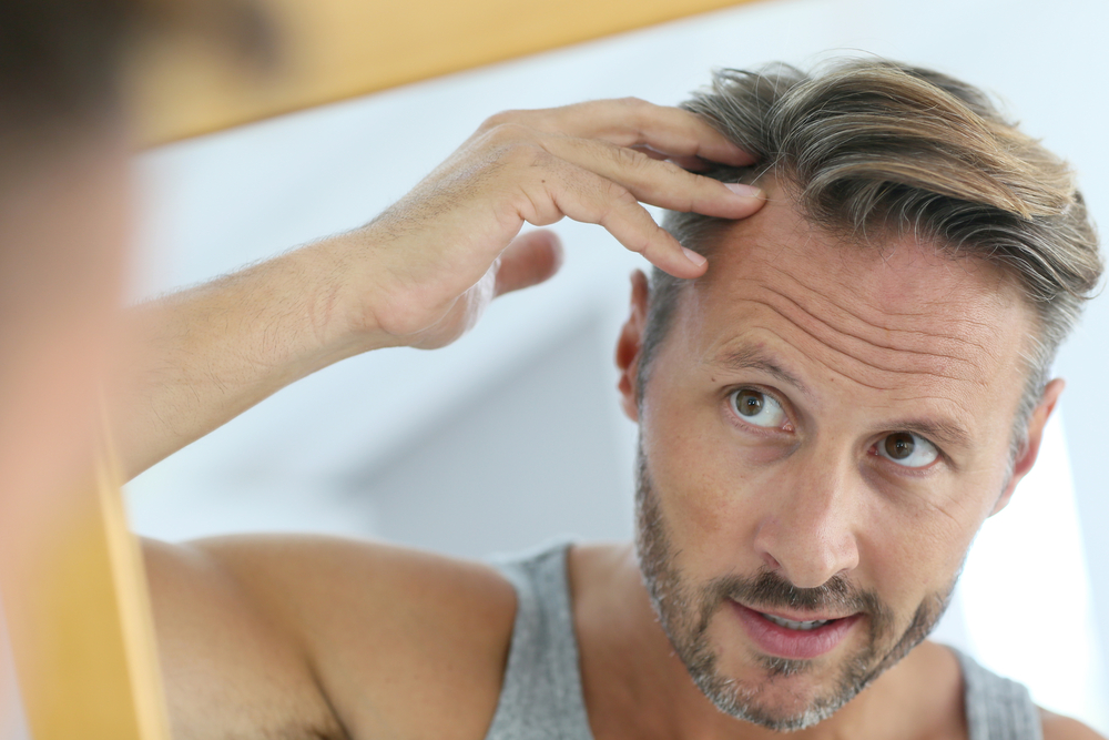 Hair Loss Myths