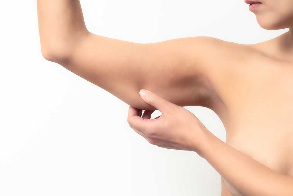 Fight the "Bat Wing": How Laser Lipo Can Slim Your Arms - Vargas Face and Skin Center