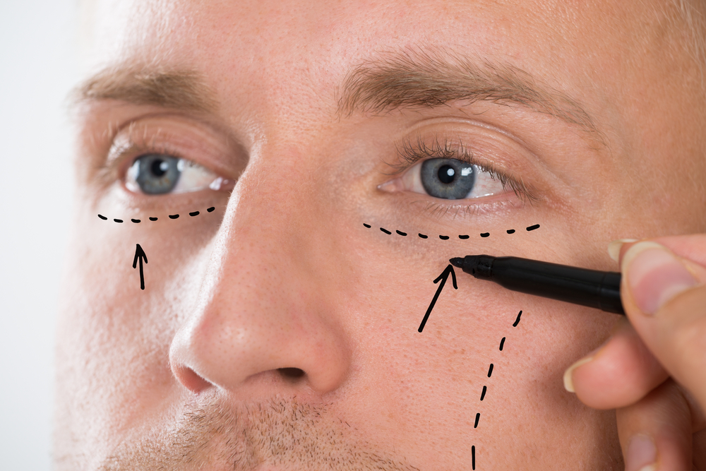 Common Cosmetic Surgery Procedures for Men