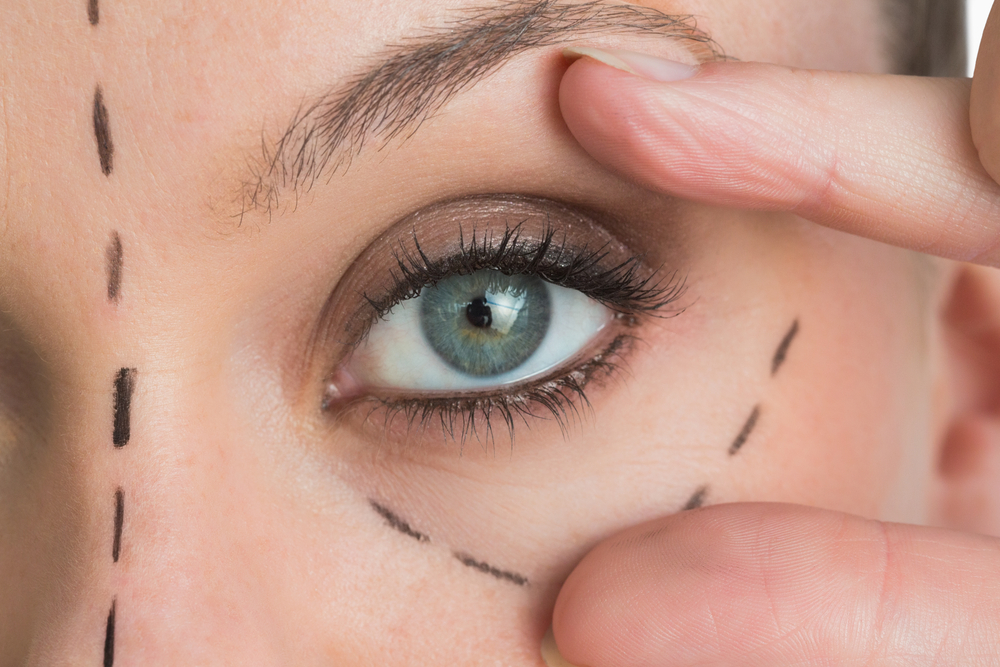 Kansas City Eye Lifts - Cosmetic Surgery - Vargas Face & Skin Center