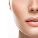 Upper Lip Lift Vs. Lip Fillers: A Look At Benefits And Disadvantages