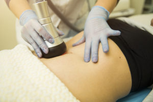 laser-lipo-procedure