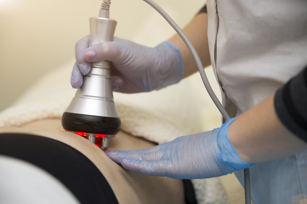 laser-liposuction-procedure