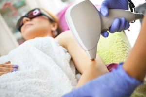 laser-hair-removal-arm