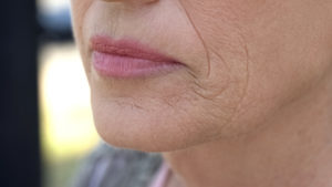 older-woman-lip-wrinkles