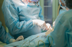 surgical-liposuction