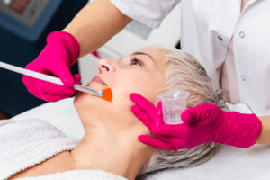 woman-getting-chemical-peel