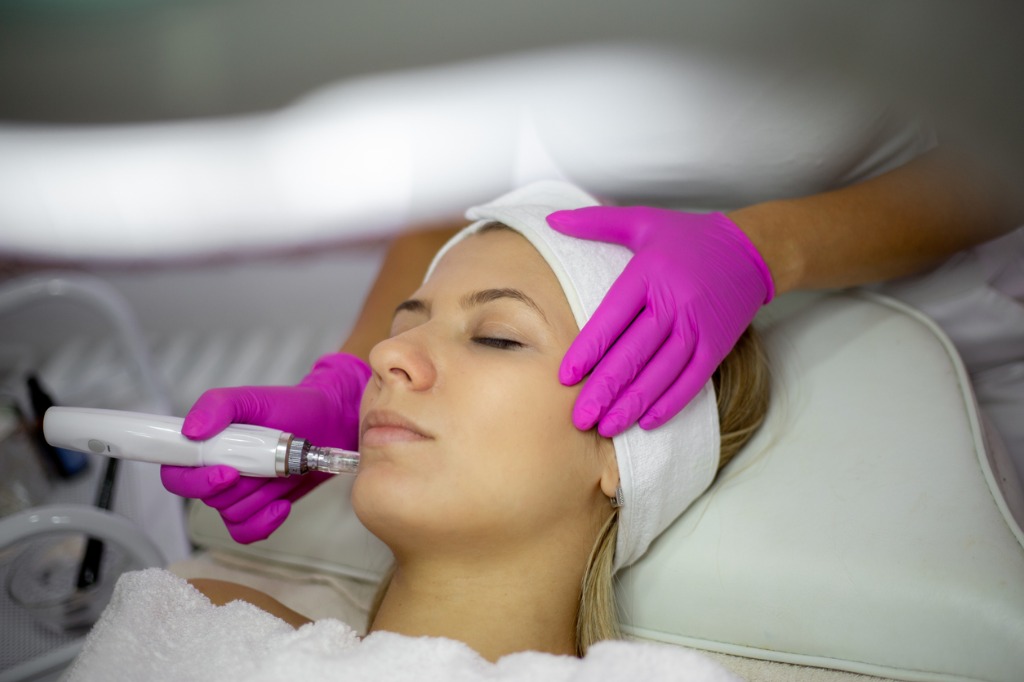 woman-undergoing-microneedling