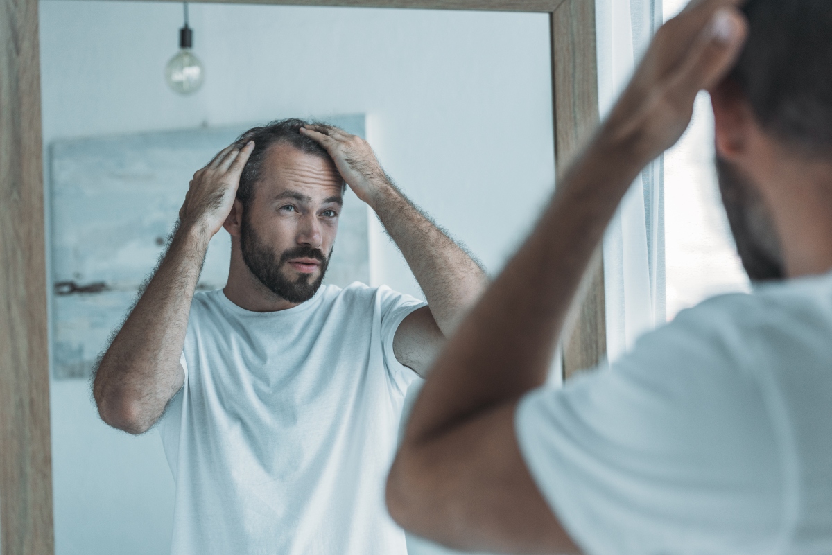 man looking at his hairline