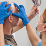 The Real Facts Behind Hair Transplant Myths