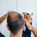 Is Hair Loss Genetic?