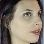 Chin Augmentation Before & After Patient #96